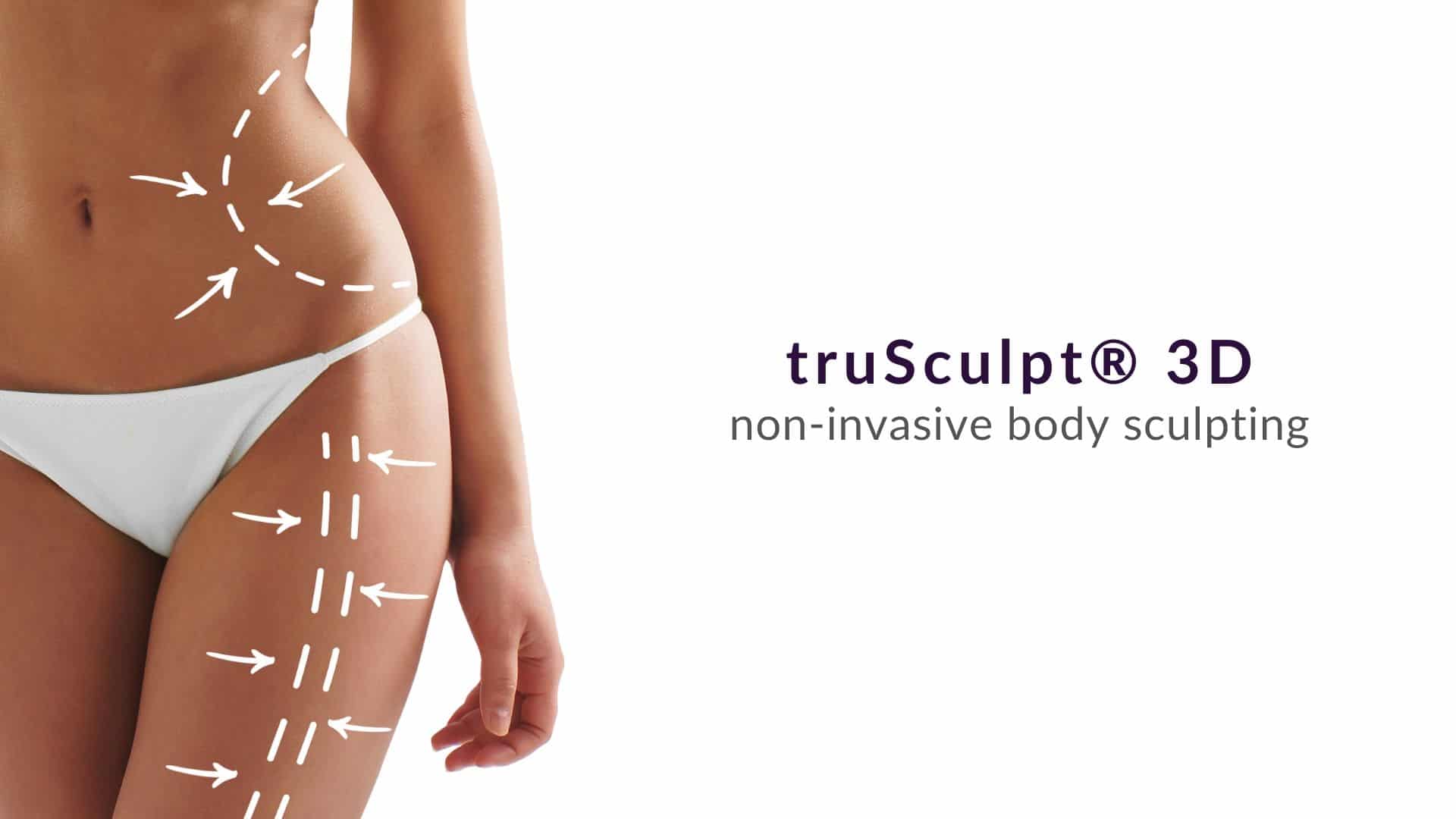 Trusculpt 3D